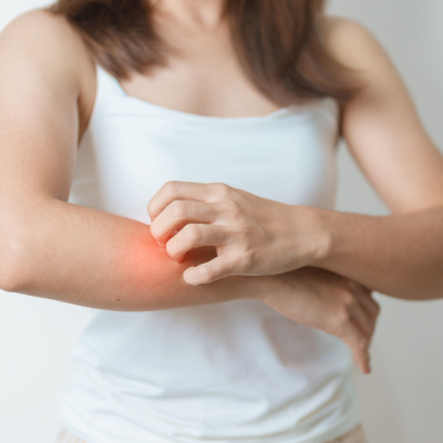 Clinical Studies for Psoriasis